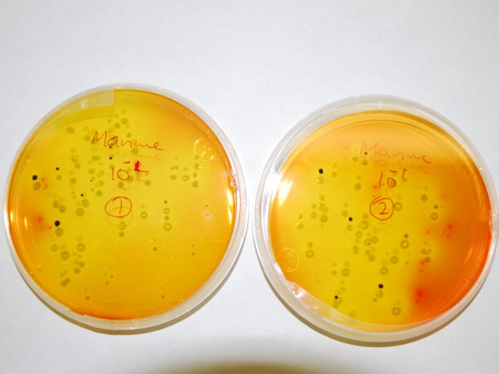Agar plates with microbe colonies growing
